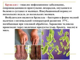Бруцеллёз - это опасно. Бруцеллёз - это опасно.