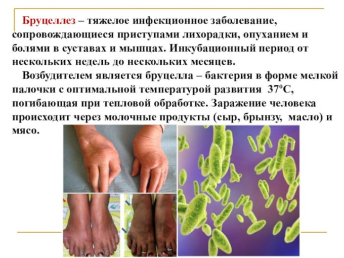 Бруцеллёз - это опасно. Бруцеллёз - это опасно.